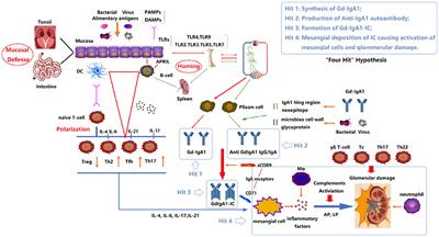 The Role of Immune Modulation in Pathogenesis of IgA Nephropathy